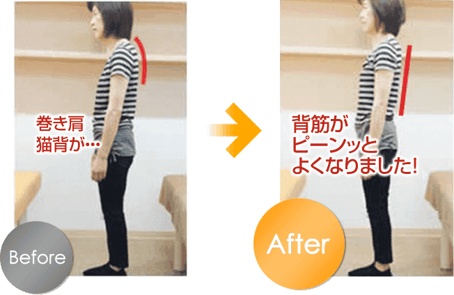 慢性的な首や肩の痛みがあった京都市にお住まいのK様(50代)の改善例です